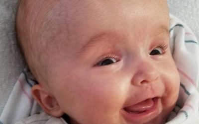 Sarah: Hydrocephalus