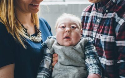 Alyssa and Ben: Aplasia Cutis Congenita