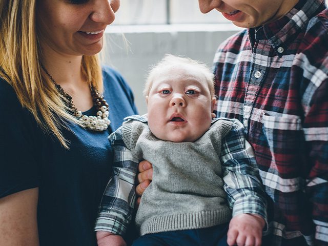 Alyssa and Ben: Aplasia Cutis Congenita