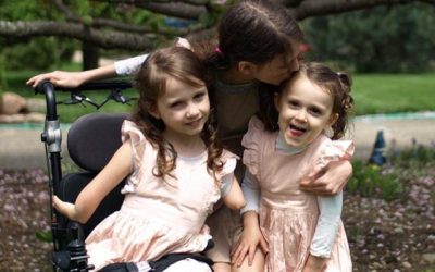 Miggy: Microgastria and Limb Reduction Complex