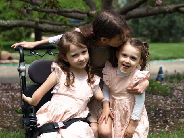 Miggy: Microgastria and Limb Reduction Complex