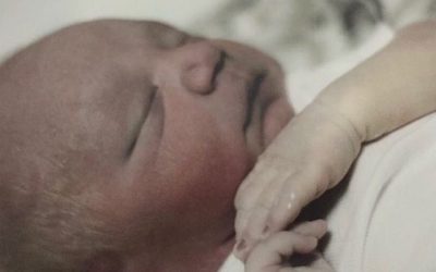 Mandy and Steven: Hydrops Fetalis, Bilateral Renal Agenesis