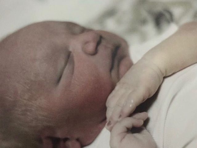 Mandy and Steven: Hydrops Fetalis, Bilateral Renal Agenesis