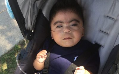 Lauricia: Cornelia de Lange Syndrome