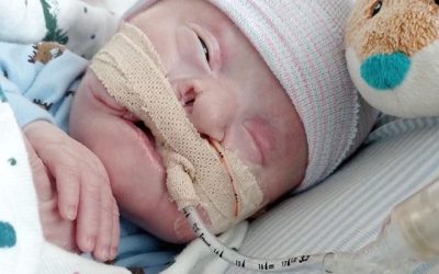 Brittany and Tyler: Hydrocephalus, Encephalocele, Amniotic Band syndrome