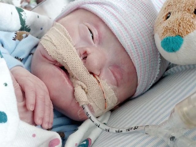 Brittany and Tyler: Hydrocephalus, Encephalocele, Amniotic Band syndrome