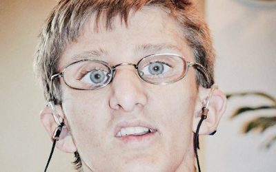 Valorie: Cockayne Syndrome