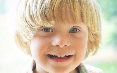 Nikki and Alan: Down Syndrome