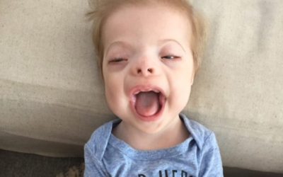 Nicole: Single Gene Mutation