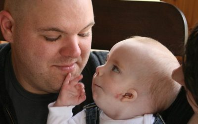 Jessica and Johnny: Goldenhar Syndrome