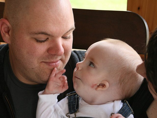 Jessica and Johnny: Goldenhar Syndrome