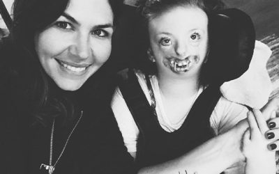 Natalie: Rett Syndrome and Facial Differences