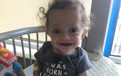 Nikki and Sean: OI- Brittle Bones