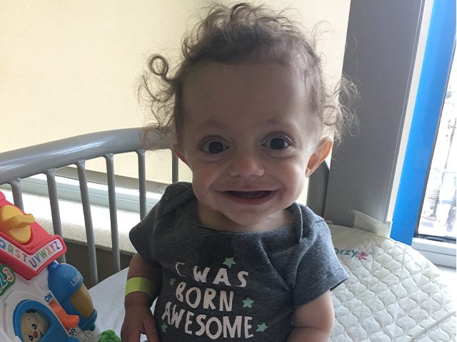 Nikki and Sean: OI- Brittle Bones