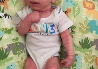 Passing On A Genetic Condition