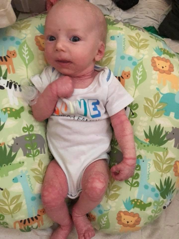 Passing On A Genetic Condition