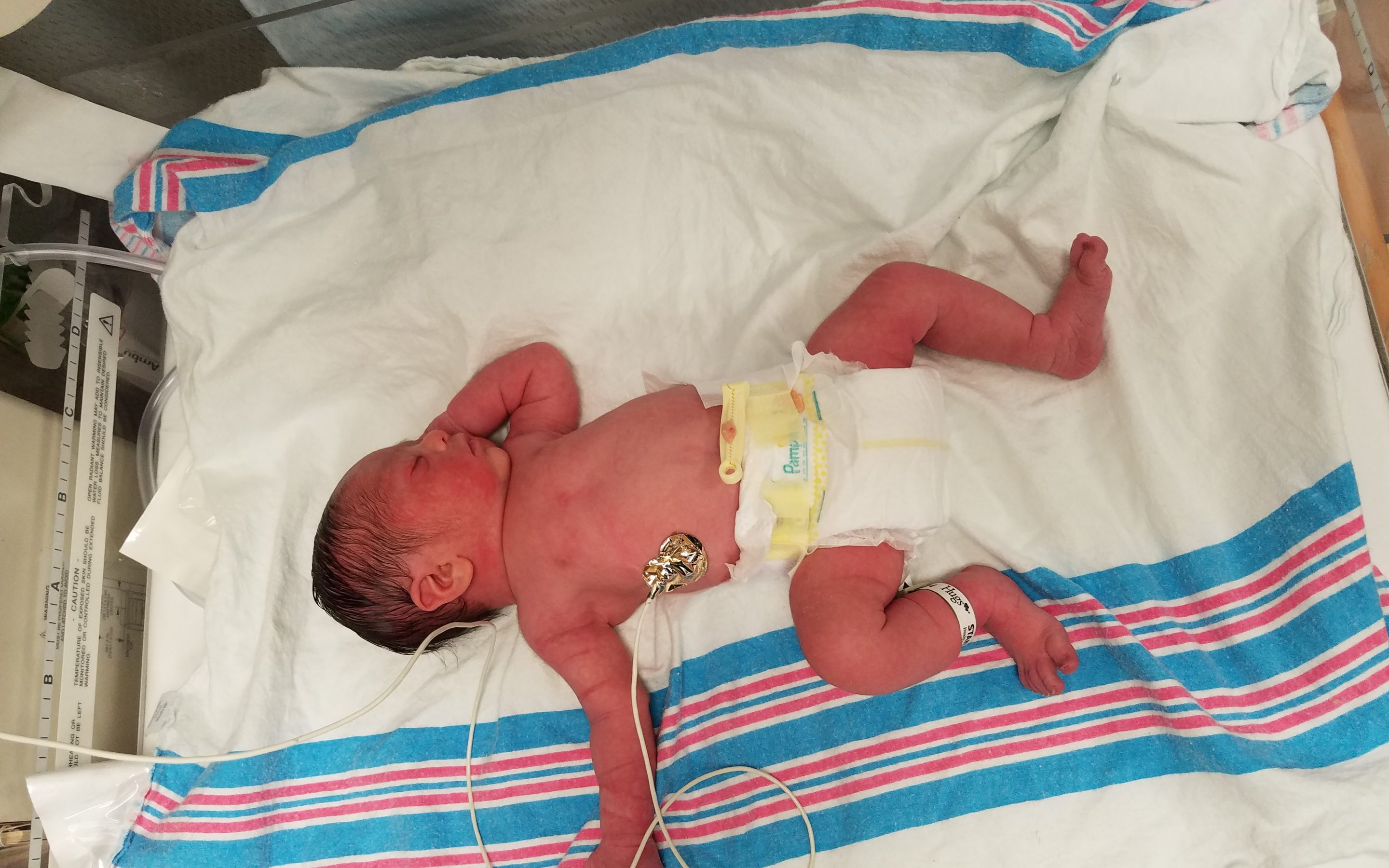 The Journey Of Laksh Kumar – A Super Cute Little Guy With An Extra Chromosome