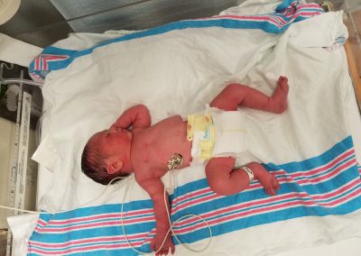 The Journey Of Laksh Kumar – A Super Cute Little Guy With An Extra Chromosome