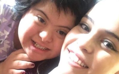 Candace: Down Syndrome