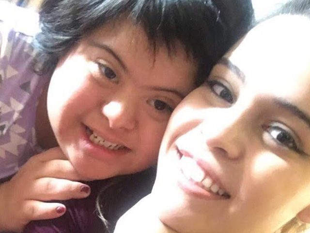 Candace: Down Syndrome