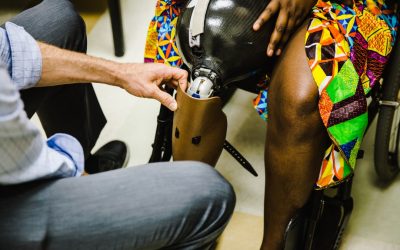 Prosthetics for Children